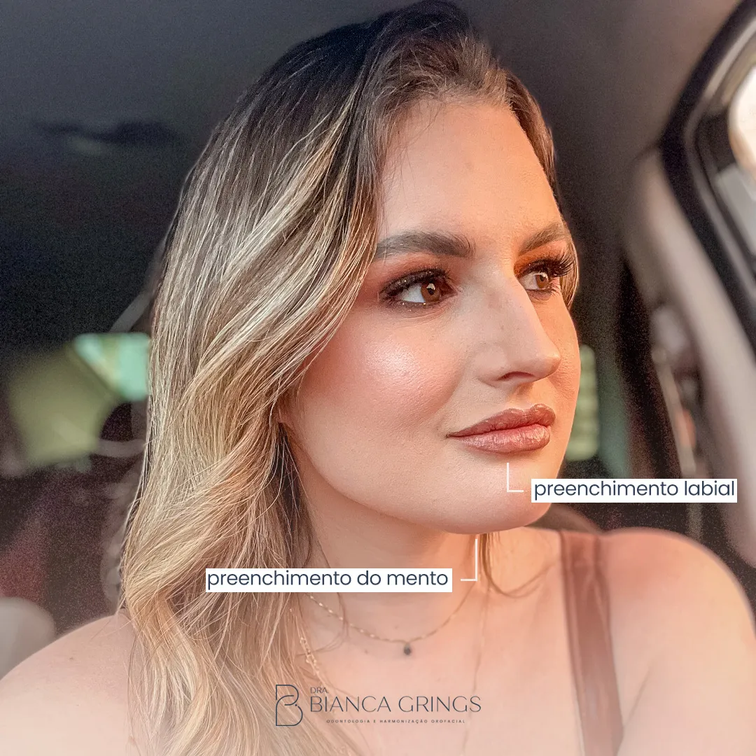 Bianca Grings - Imagem 9